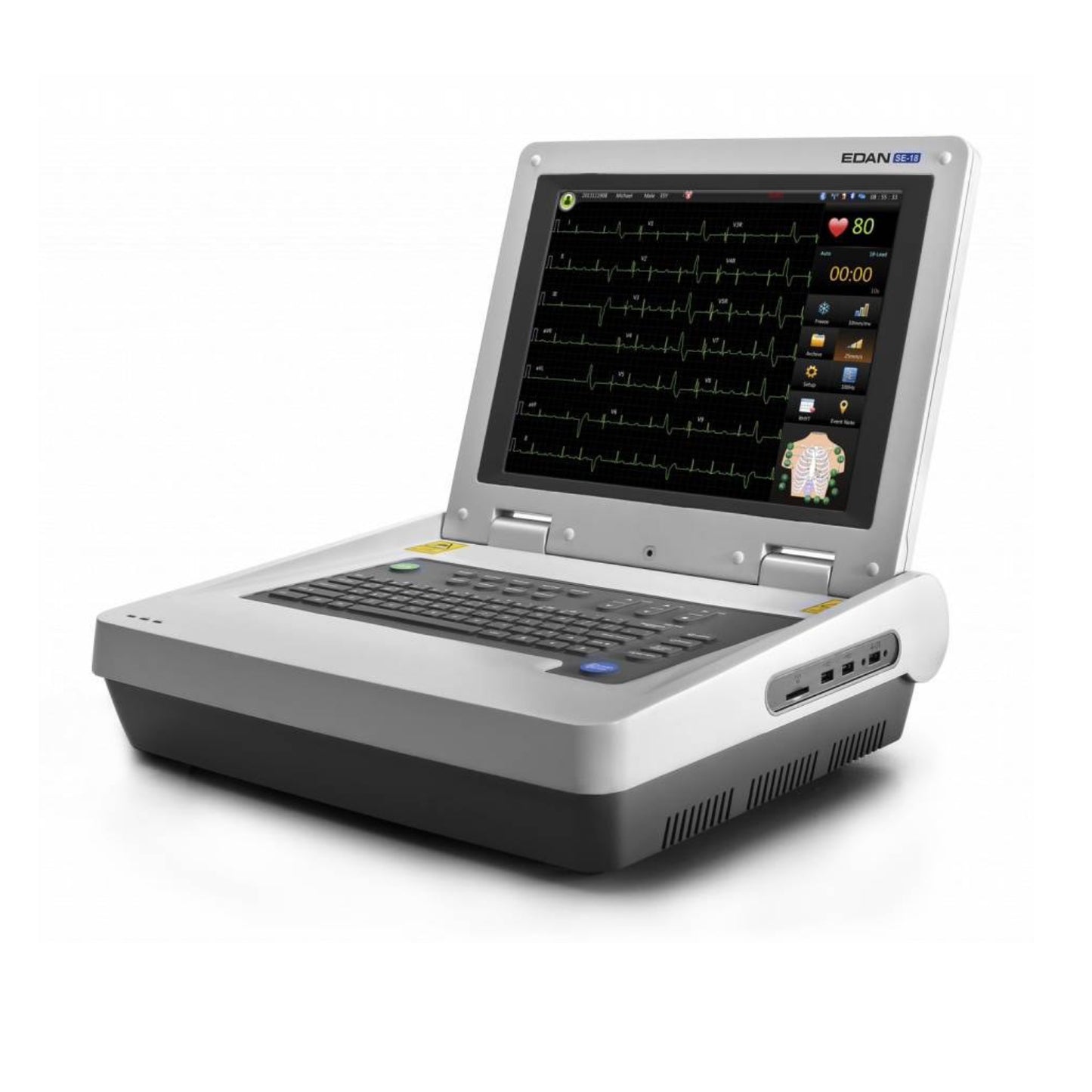 With Touch Screen and Wifi Edan SE-18 Electrocardiograph, 12 channel Edan SE-18 ECG - Pet medical equipment