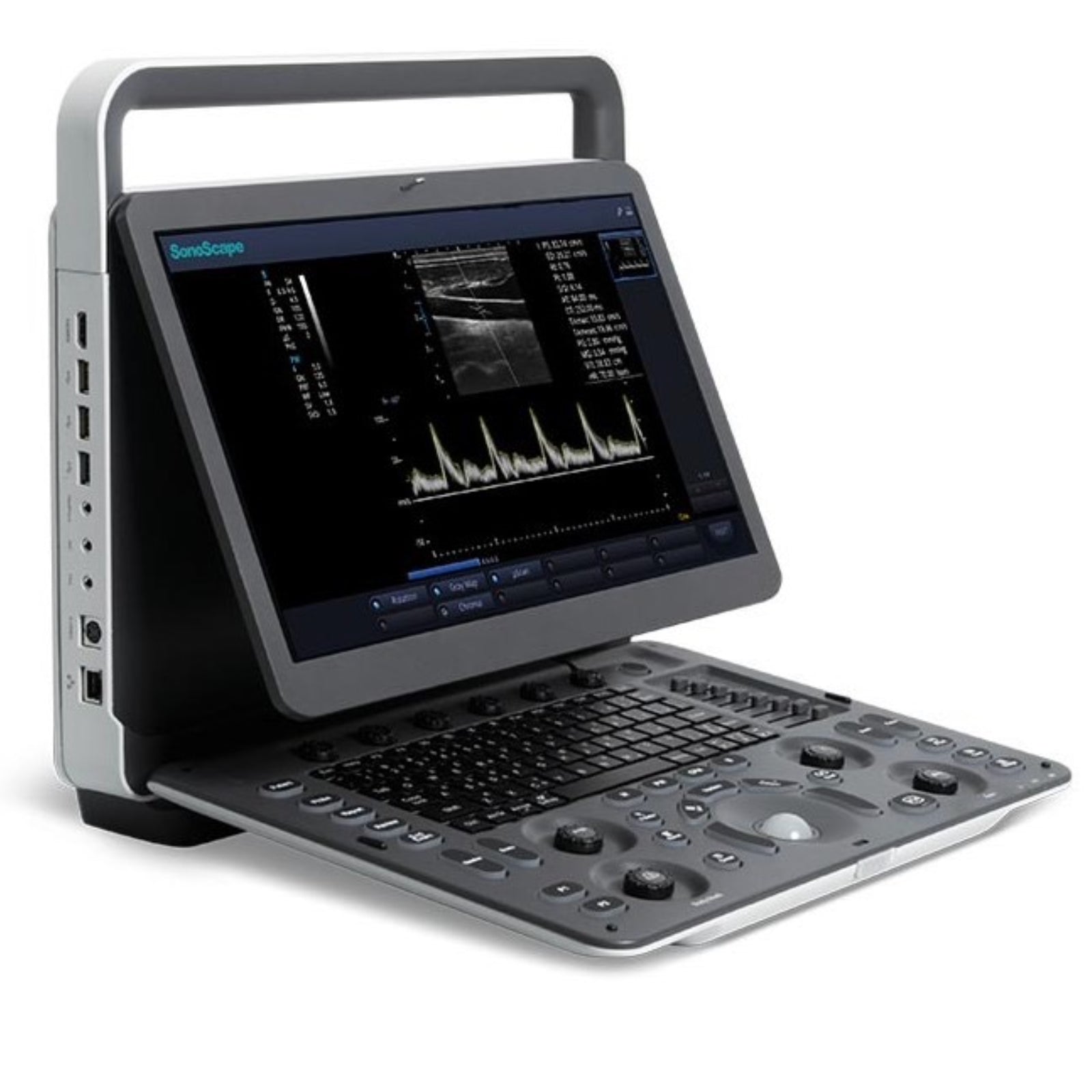 Sonoscape E1V Portable Black White Scanner Slim Design Color Doppler Ultrasound - Pet medical equipment