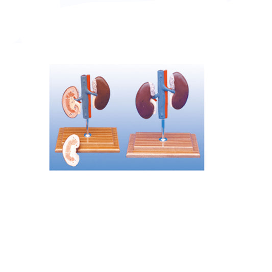 The Dissection Model of Pig kidney(2parts) - Pet medical equipment